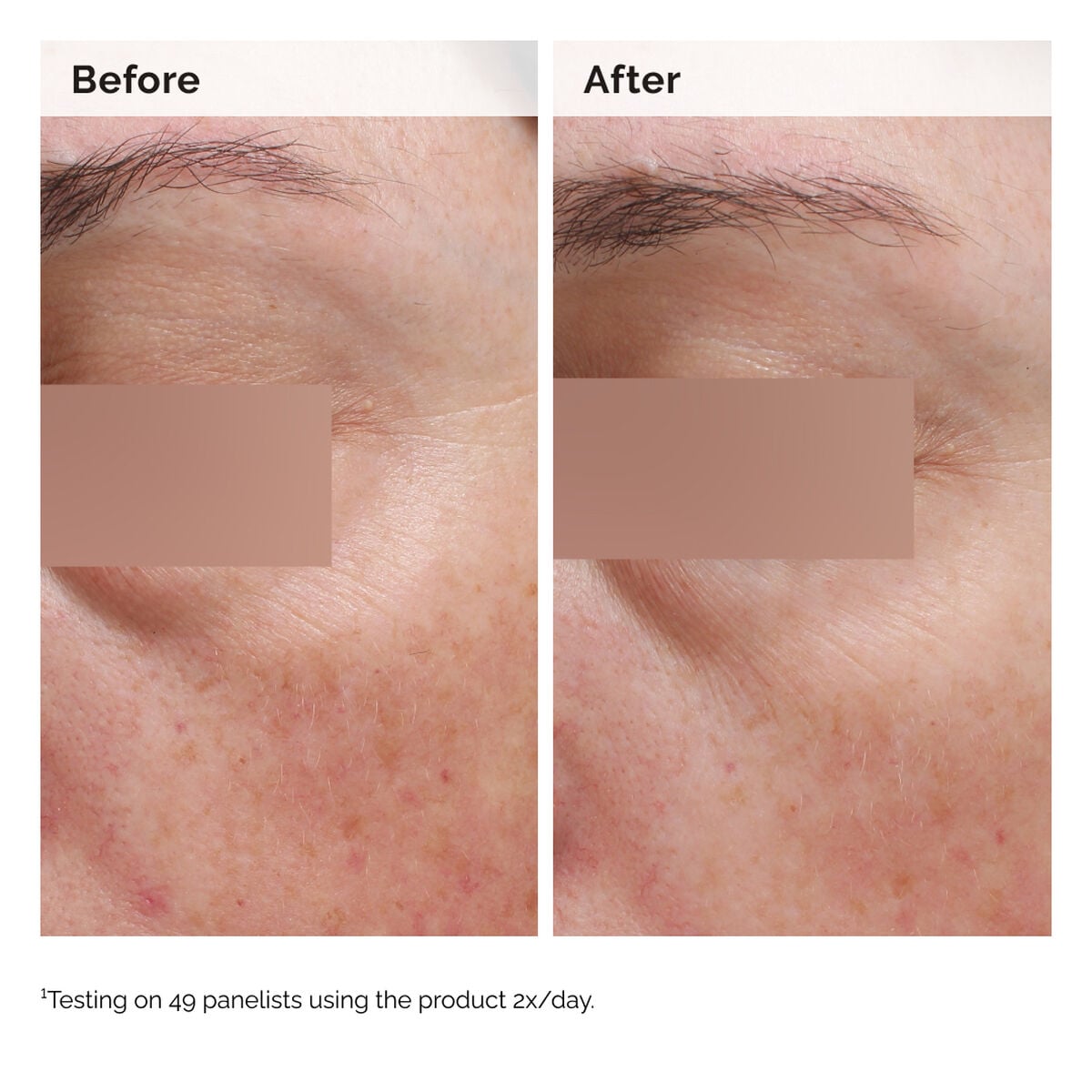 niacinamide-5-face-and-body-emulsion-t0 2024-08-23-ORD-Nia-5pct-Face-Body-B-A-Elasticity-Global-02-1x1.jpg