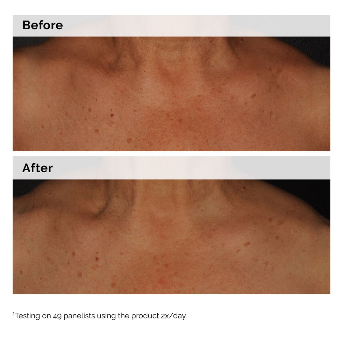 niacinamide-5-face-and-body-emulsion-t0 2024-08-23-ORD-Nia-5pct-Face-Body-B-A-Global-02-1x1.jpg