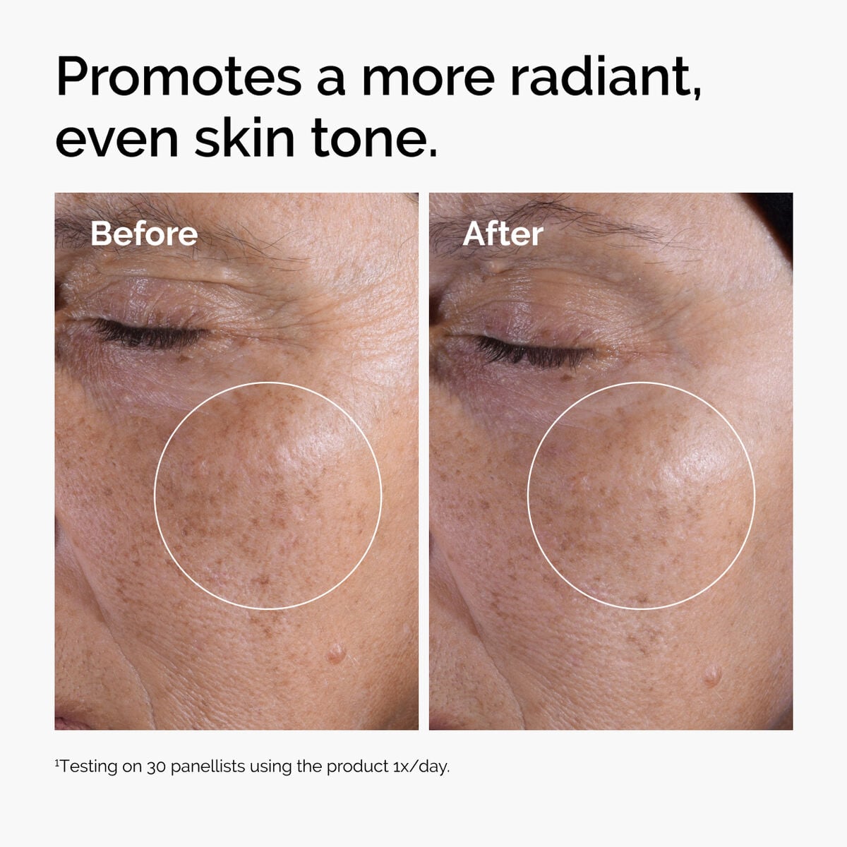 glycolic-acid-7-exfoliating-toner-s4 ord-glycolic-before-after-radiance.jpg