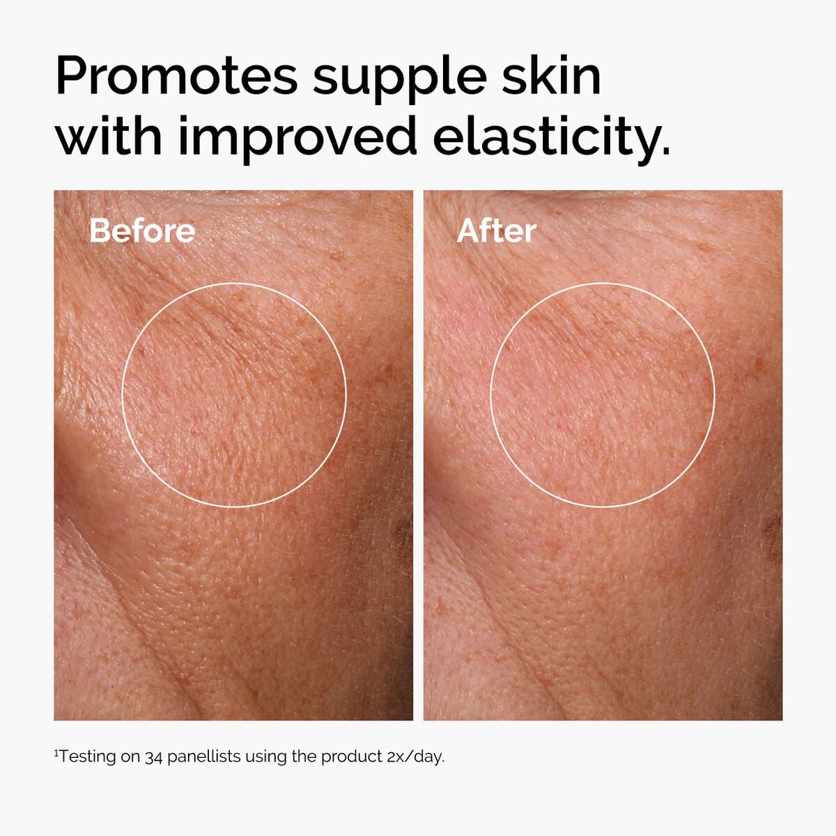 hyaluronic-acid-2-b5-with-ceramides-a0 ord-hyaluronic-acid-2pct-b5-hydrating-serum-before-after-elasticity.jpg