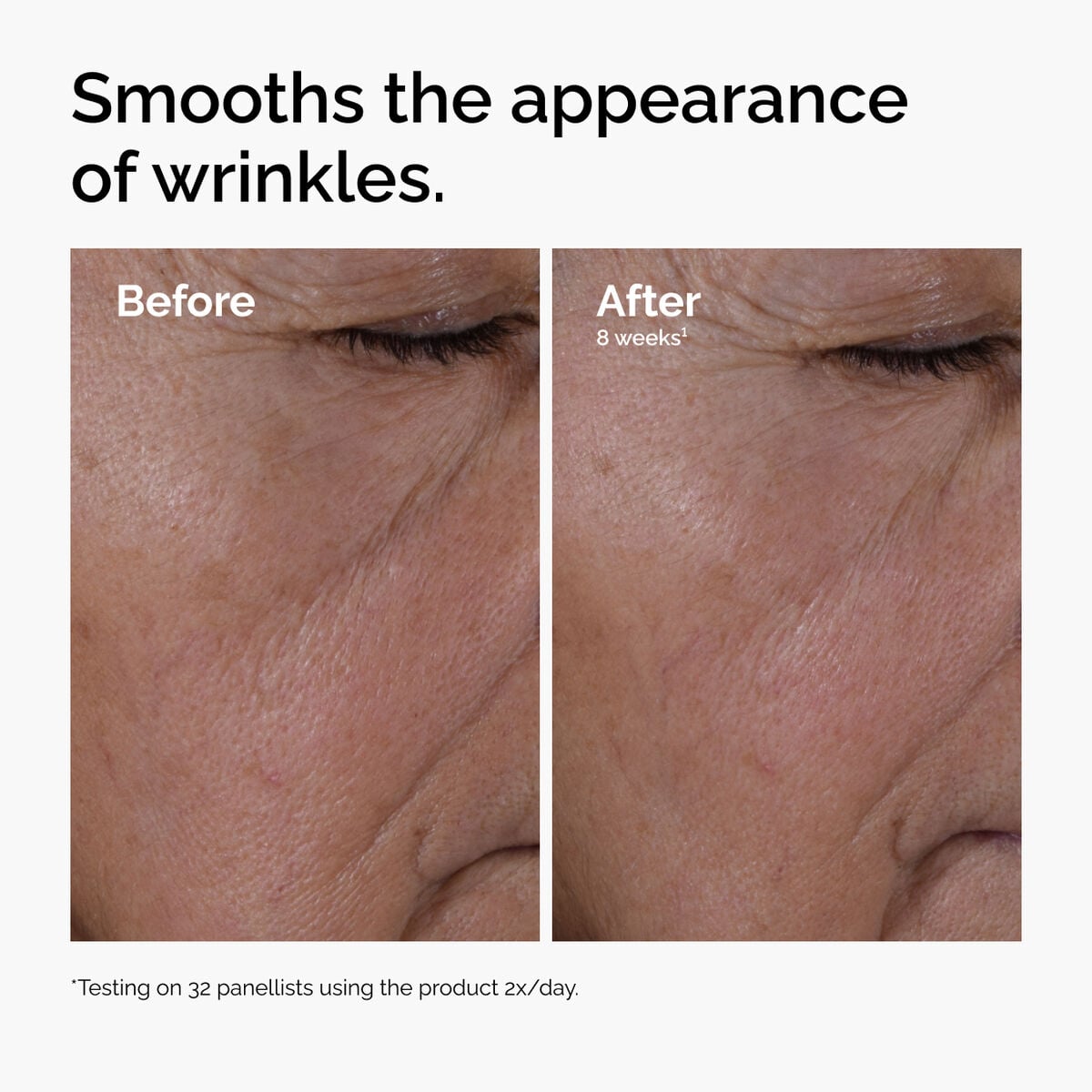 multi-peptide-ha-serum-w0 ord-multi-peptide-ha-serum-wrinkles-before-after.jpg