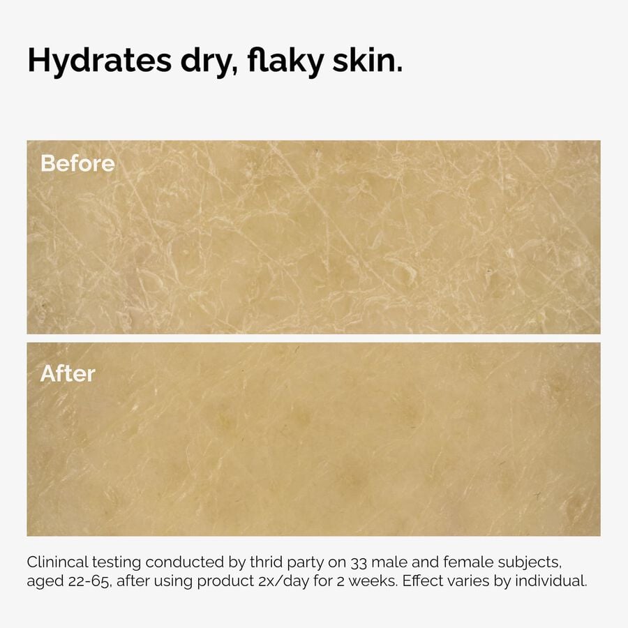 the-body-care-collection-n6 ord-natural-moisturizing-factors-inulin-body-before-after-graphic-02.jpg