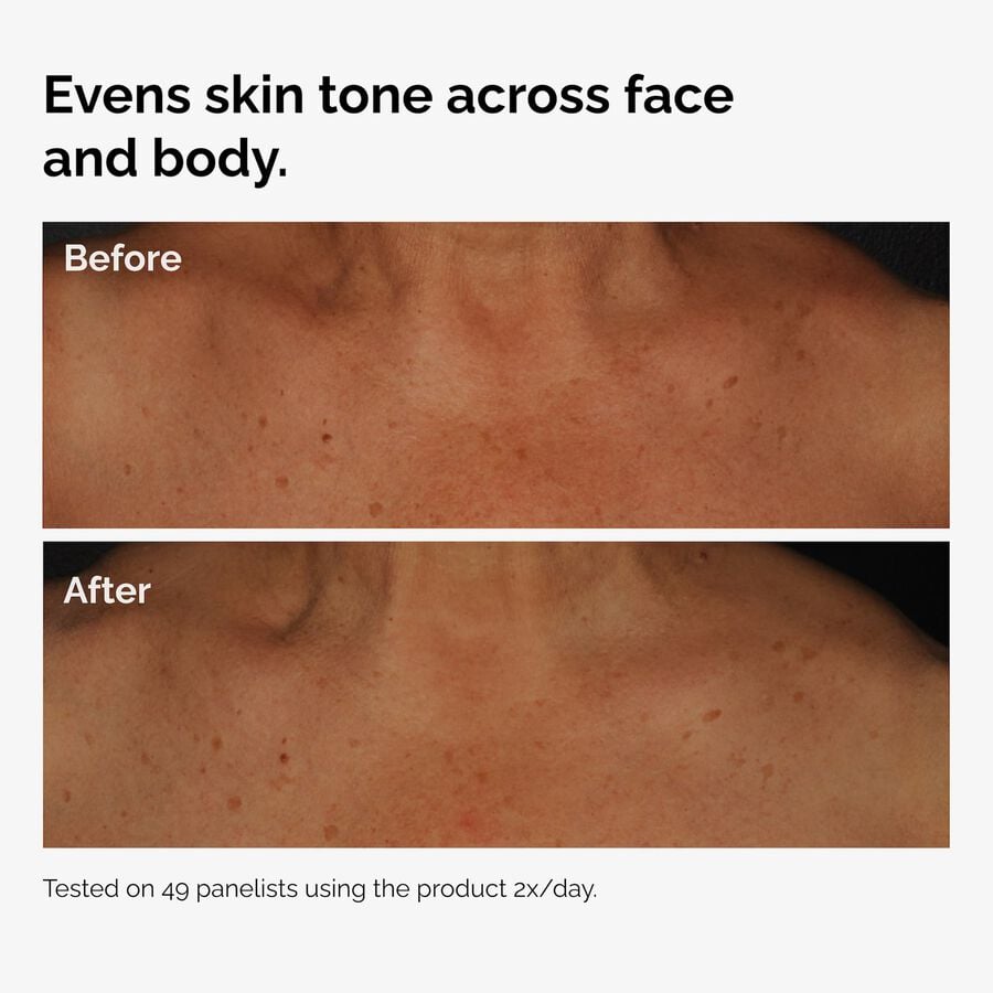 the-body-care-collection-n6 ord-niacinamide-face-body-serum-before-after-even-tone-graphic.jpg