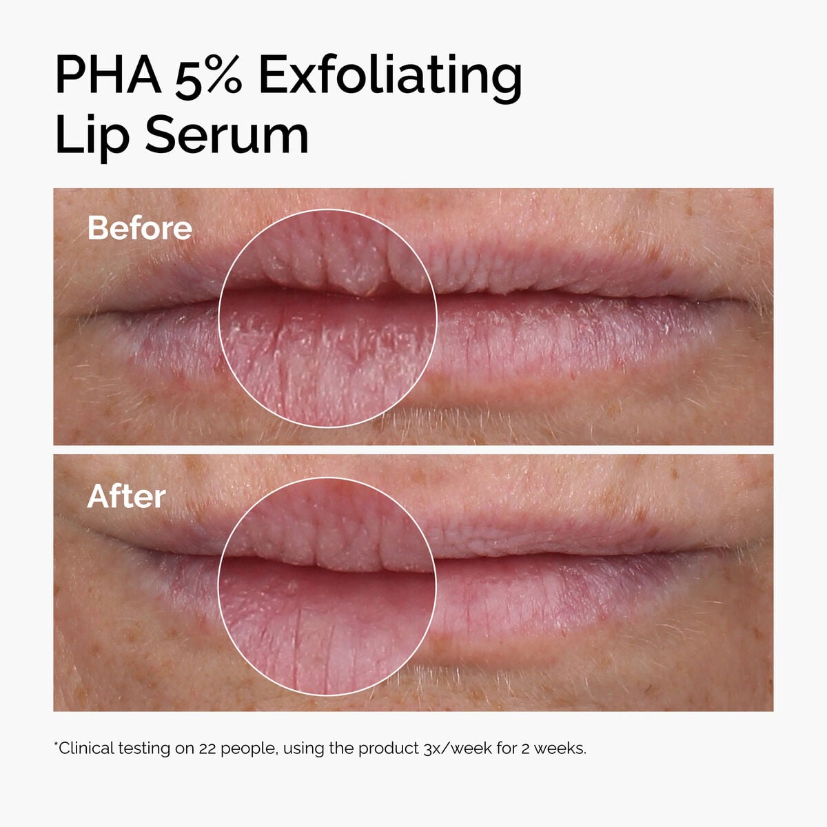 pha-5-exfoliating-lip-serum-u4 ord-pha-5pct-lip-exfoliating-serum-before-after.jpg